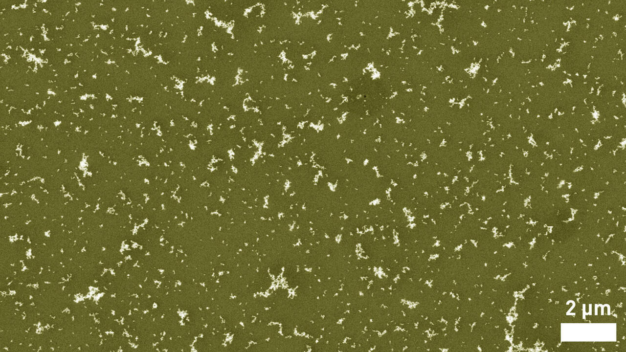 Scanning electron micrograph of soot aerosol particles, unit of length 2 µm 