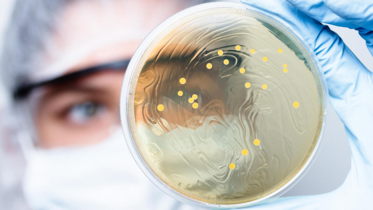 Scientist in the background with petri dish with bacteria in his hand (foreground)